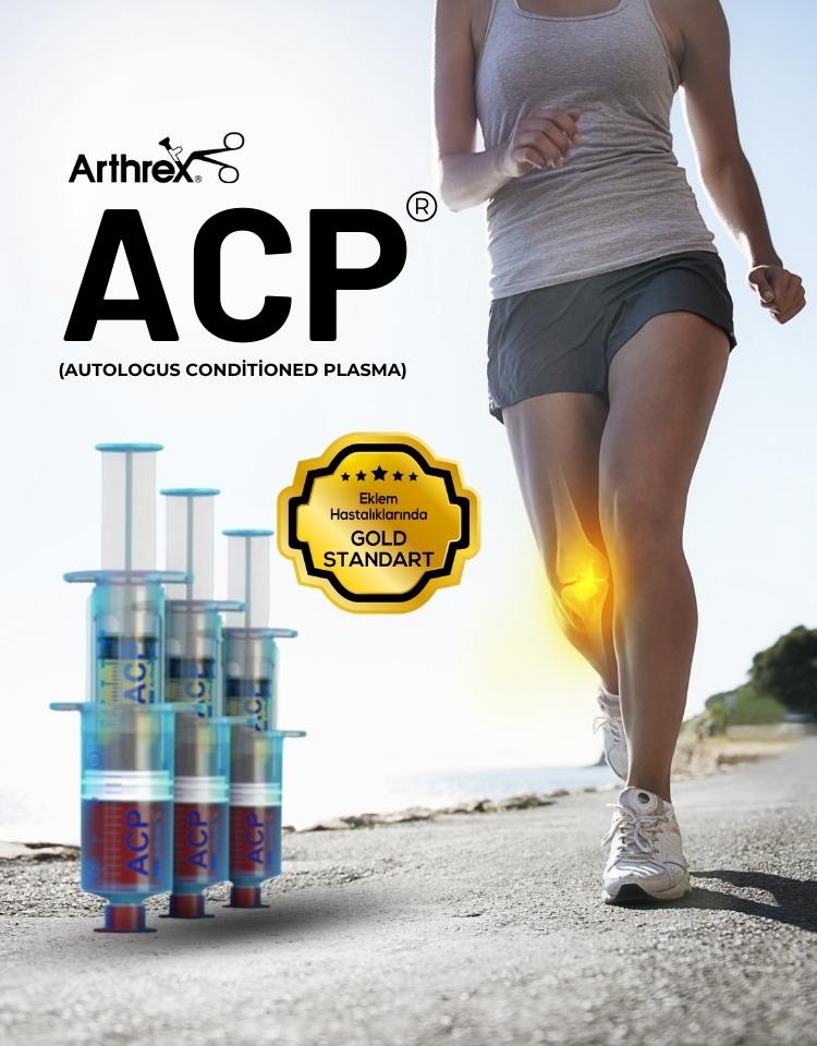Arthrex ACP®  (Autologous Conditioned Plasma)