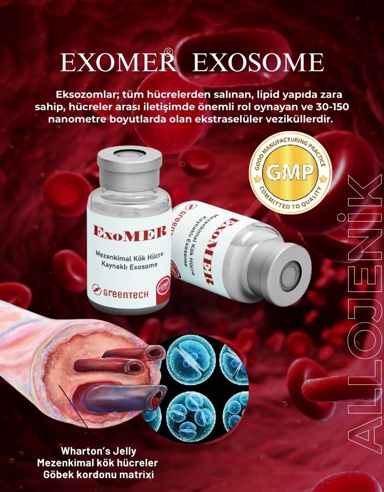 ExoMER Eksozom